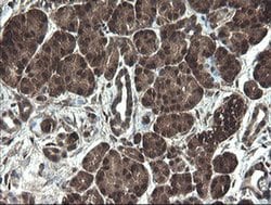 APP Monoclonal Antibody (OTI7B8), TrueMAB , OriGene 100 &mu;L; Unconjugated:Antibodies,