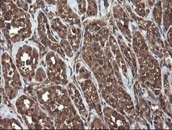 APP Monoclonal Antibody (OTI7B8), TrueMAB , OriGene 100 &mu;L; Unconjugated:Antibodies,
