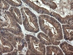 APP Monoclonal Antibody (OTI7B8), TrueMAB , OriGene 100 &mu;L; Unconjugated:Antibodies,