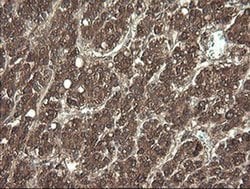 APP Monoclonal Antibody (OTI7B8), TrueMAB , OriGene 100 &mu;L; Unconjugated:Antibodies,