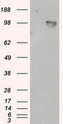 APP Monoclonal Antibody (OTI7G9), TrueMAB , OriGene 100 &mu;L; Unconjugated:Antibodies,