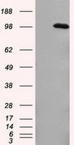 APP Monoclonal Antibody (OTI3D11), TrueMAB , OriGene 30 &mu;L; Unconjugated:Antibodies,