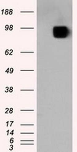 APP Monoclonal Antibody (OTI7B8), TrueMAB , OriGene:Antibodies:Primary
