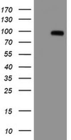 APP Monoclonal Antibody (OTI1E6), TrueMAB , OriGene 30 &mu;L; Unconjugated:Antibodies,