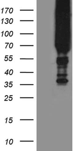APPL2 Monoclonal Antibody (OTI8F1), TrueMAB , OriGene:Antibodies:Primary