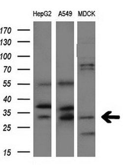 AQP1 Mouse anti-Human, Clone: OTI2D10, lyophilized, TrueMAB 100 &mu;g;