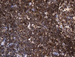 AQP8 Monoclonal Antibody (OTI1C10), TrueMAB , OriGene:Antibodies:Primary