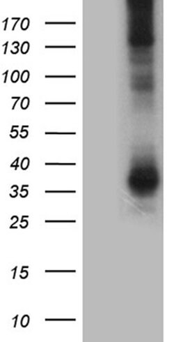 AQP8 Mouse anti-Human, Clone: OTI6E6, lyophilized, TrueMAB 100 &mu;g; Unconjugated:Antibodies,