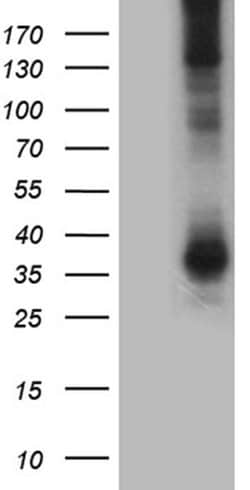 AQP8 Monoclonal Antibody (OTI6E6), TrueMAB , OriGene:Antibodies:Primary