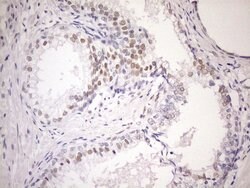AR Mouse anti-Human, Clone: OTI1D3, lyophilized, TrueMAB 100 &mu;g; Unconjugated:Antibodies,