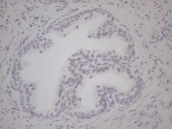 AR Monoclonal Antibody (OTI2E6), TrueMAB , OriGene:Antibodies:Primary Antibodies