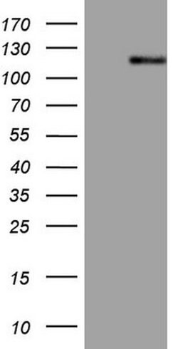 AR Mouse anti-Human, Clone: OTI1D3, lyophilized, TrueMAB 100 &mu;g; Unconjugated:Antibodies,
