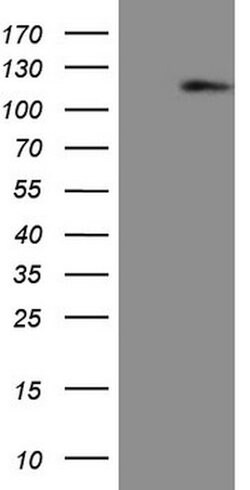 AR Mouse anti-Human, Clone: OTI2H2, lyophilized, TrueMAB 100 &mu;g; Unconjugated:Antibodies,
