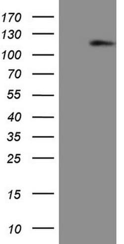 AR Monoclonal Antibody (OTI2H2), TrueMAB , OriGene:Antibodies:Primary Antibodies