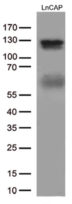 AR Monoclonal Antibody (OTI2H2), TrueMAB , OriGene:Antibodies:Primary Antibodies