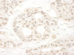 ARA70 Rabbit anti-Human, Polyclonal, Bethyl Laboratories 10 &mu;L; Unconjugated:Antibodies,