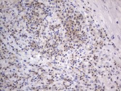 ARAF Monoclonal Antibody (OTI2F8), TrueMAB , OriGene 30 &mu;L; Unconjugated:Antibodies,