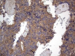 ARAF Monoclonal Antibody (OTI2G9), TrueMAB , OriGene 100 &mu;L; Unconjugated:Antibodies,