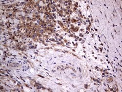 ARAF Monoclonal Antibody (OTI2G9), TrueMAB , OriGene 100 &mu;L; Unconjugated:Antibodies,