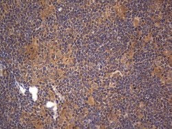 ARAF Monoclonal Antibody (OTI2G9), TrueMAB , OriGene 100 &mu;L; Unconjugated:Antibodies,