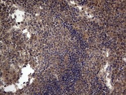 ARAF Monoclonal Antibody (OTI2G9), TrueMAB , OriGene 100 &mu;L; Unconjugated:Antibodies,