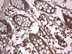 ARAF Monoclonal Antibody (OTI2G9), TrueMAB , OriGene 100 &mu;L; Unconjugated:Antibodies,