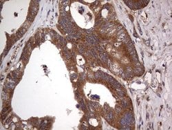 ARAF Monoclonal Antibody (OTI2G9), TrueMAB , OriGene 100 &mu;L; Unconjugated:Antibodies,