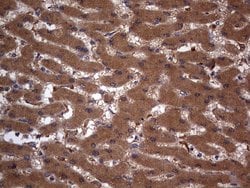 ARAF Monoclonal Antibody (OTI2G9), TrueMAB , OriGene 100 &mu;L; Unconjugated:Antibodies,