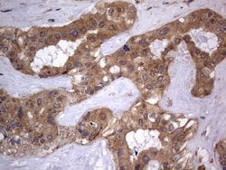 ARAF Monoclonal Antibody (OTI2G9), TrueMAB , OriGene 100 &mu;L; Unconjugated:Antibodies,