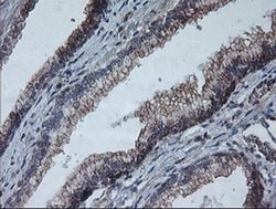 ARCN1 Mouse anti-Canine, Human, Rat, Clone: OTI4H9, liquid, TrueMAB 100