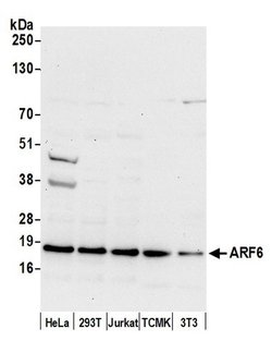 ARF6/ADP Ribosylation Factor 6 Polyclonal Antibody, Bethyl Laboratories