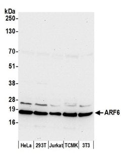 ARF6/ADP Ribosylation Factor 6 Polyclonal Antibody, Bethyl Laboratories