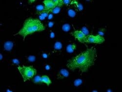 ARFGAP1 Monoclonal Antibody (OTI2C5), TrueMAB , OriGene 100 &mu;L; Unconjugated:Antibodies,
