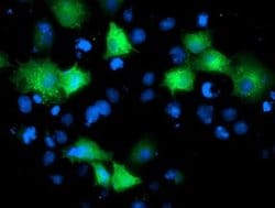 ARFGAP1 Monoclonal Antibody (OTI 2C10), TrueMAB , OriGene:Antibodies:Primary