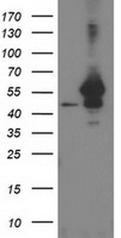 ARFGAP1 Monoclonal Antibody (OTI1H6), TrueMAB , OriGene 100 &mu;L; Unconjugated:Antibodies,