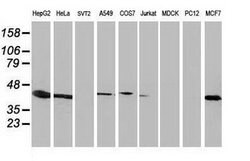 ARFGAP1 Mouse anti-Human, Clone: OTI1H6, lyophilized, TrueMAB 100 &mu;g;