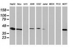 ARFGAP1 Monoclonal Antibody (OTI1H6), TrueMAB , OriGene 100 &mu;L; Unconjugated:Antibodies,