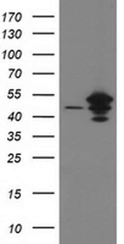 ARFGAP1 Monoclonal Antibody (OTI2C6), TrueMAB , OriGene 100 &mu;L; Unconjugated:Antibodies,