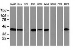 ARFGAP1 Monoclonal Antibody (OTI2C6), TrueMAB , OriGene 100 &mu;L; Unconjugated:Antibodies,