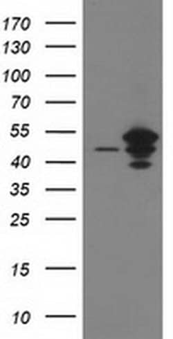 ARFGAP1 Monoclonal Antibody (OTI1F9), TrueMAB , OriGene 100 &mu;L; Unconjugated:Antibodies,