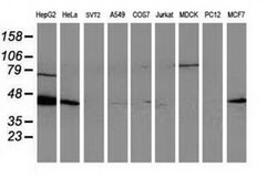ARFGAP1 Monoclonal Antibody (OTI1H4), TrueMAB , OriGene 100 &mu;L; Unconjugated:Antibodies,