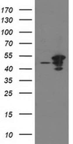 ARFGAP1 Monoclonal Antibody (OTI2C5), TrueMAB , OriGene:Antibodies:Primary