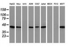 ARFGAP1 Monoclonal Antibody (OTI2C5), TrueMAB , OriGene 100 &mu;L; Unconjugated:Antibodies,