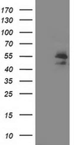 ARFGAP1 Monoclonal Antibody (OTI 2C10), TrueMAB , OriGene 30 &mu;L; Unconjugated:Antibodies,