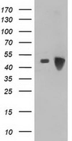 ARFGAP1 Monoclonal Antibody (OTI2D5), TrueMAB , OriGene 30 &mu;L; Unconjugated:Antibodies,