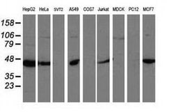 ARFGAP1 Monoclonal Antibody (OTI2D5), TrueMAB , OriGene 30 &mu;L; Unconjugated:Antibodies,