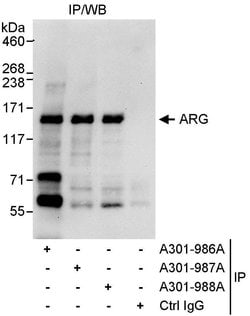 ARG Rabbit anti-Human, Polyclonal, Bethyl Laboratories 10 &mu;L; Unconjugated:Antibodies,