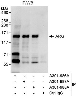ARG Rabbit anti-Human, Polyclonal, Bethyl Laboratories 10 &mu;L; Unconjugated:Antibodies,