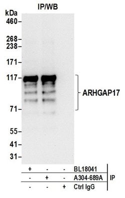 ARHGAP17 Rabbit anti-Human, Polyclonal, Bethyl Laboratories 100 &mu;L;