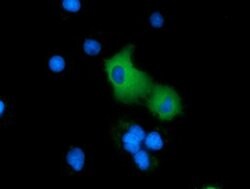 ARHGAP25 Monoclonal Antibody (OTI11C4), TrueMAB , OriGene 100 &mu;L; Unconjugated:Antibodies,